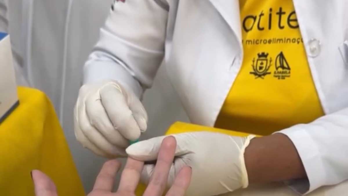 Julho Amarelo –Prefeitura de Ilhabela promove ação com testes rápidos e orientações na Praça Allan Kardec nesta terça (28) b